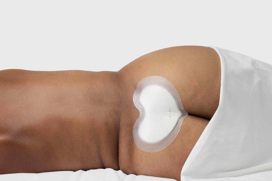 Applikationsvideo Biatain® Silicone Sakrum - Klein