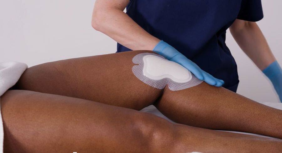 Applikationsvideo Biatain® Silicone - Multishape