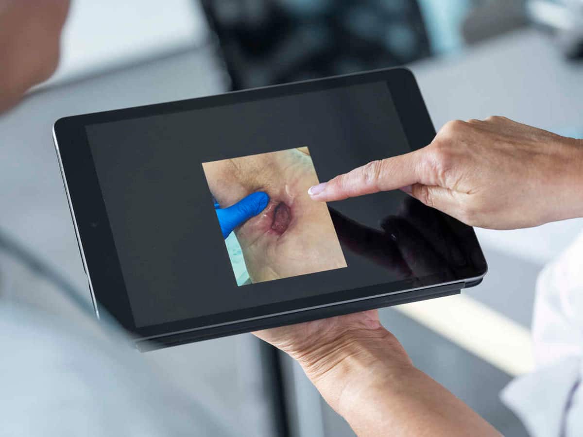 Relevanz des Exsudatmanagements