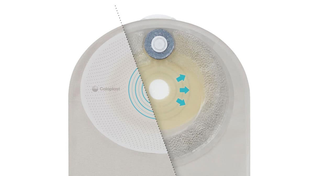 SenSura Mio Stomaversorgung gezeigt links mit Basisplatte und rechts den Ringfilter