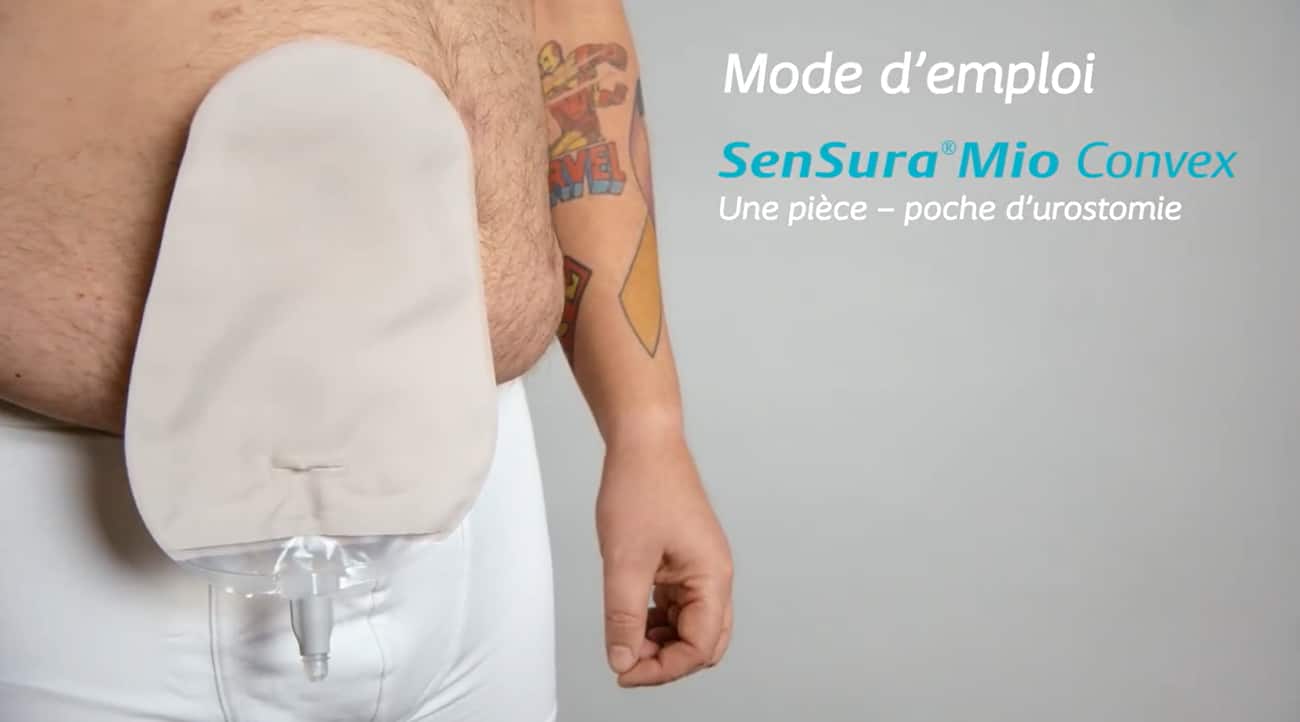 Utilisation de SenSura Mio Convex 1 pièce | Appareillage d'urostomie