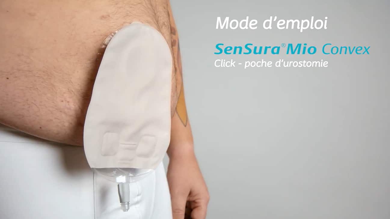 Utilisation de SenSura Mio Convex Click | Appareillage d'urostomie