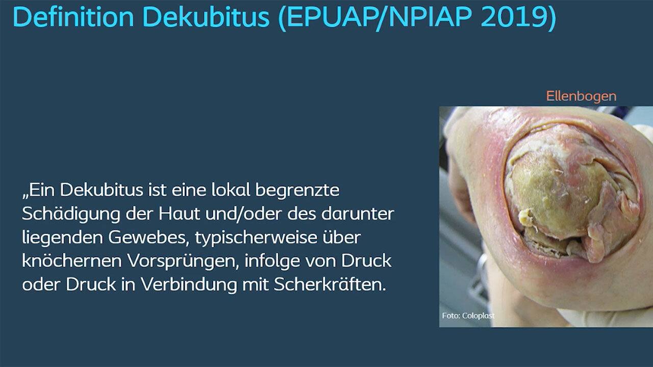 Dekubitus muss nicht sein – Prävention und Behandlung​