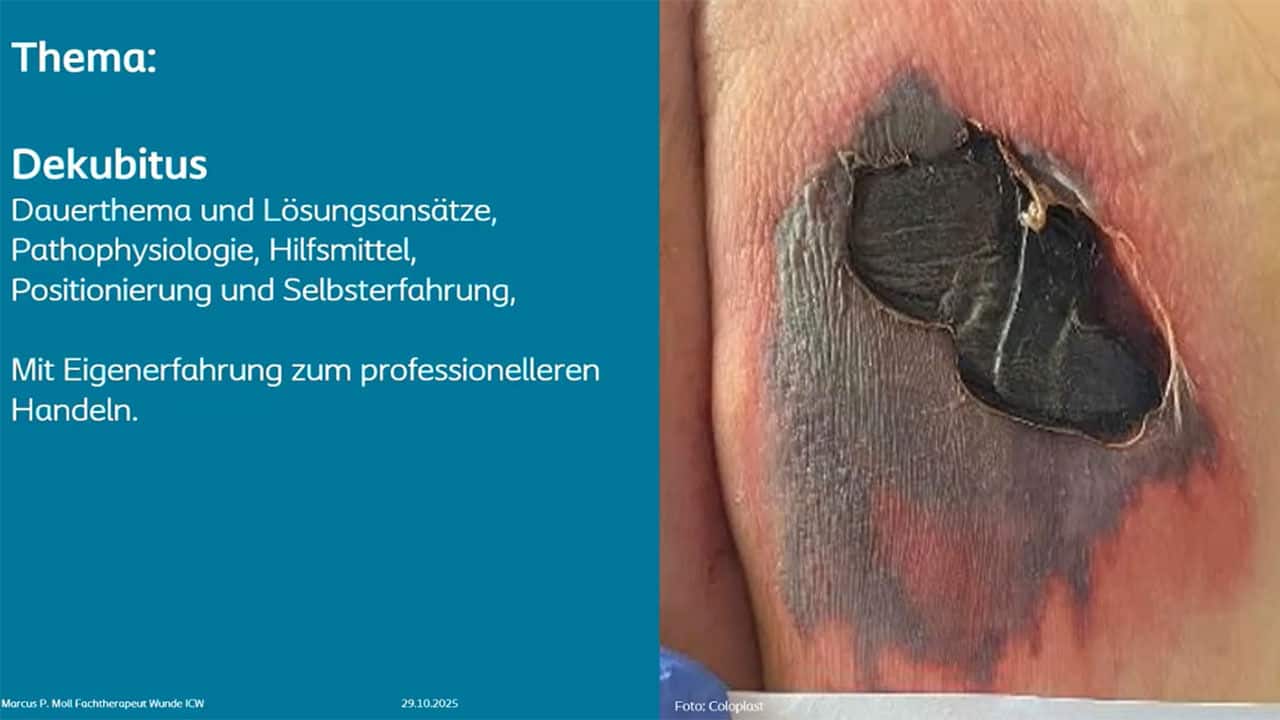 Teaser: Dekubitus muss nicht sein – Prävention und Behandlung​