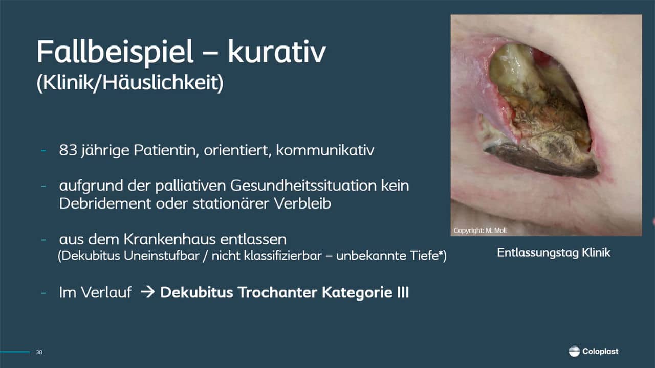 Wundversorgung in der Palliativmedizin